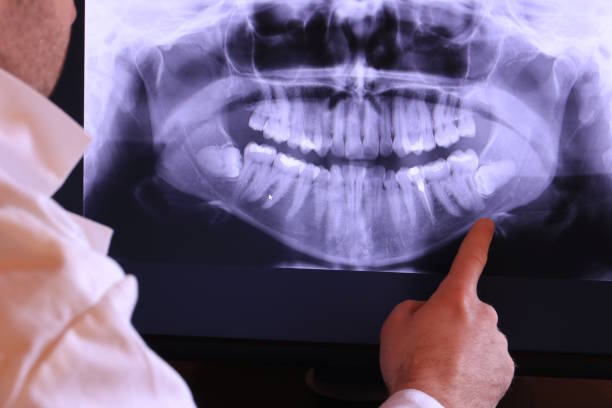 Best Urgent Care for Lost Fillings or Crowns in North Puyallup, WA